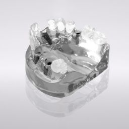 CONELOG® Demonstration model, acrylic, maxilla, 4 x SCREW-LINE, Ø 4.3 