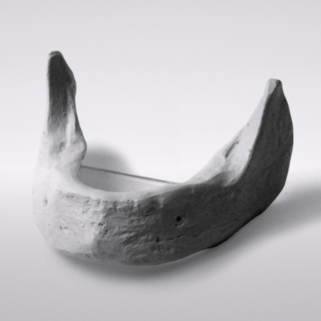 Edentulous mandible incl. mounting plate 