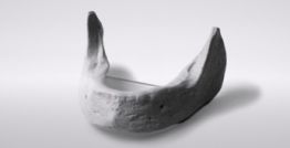 Edentulous mandible incl. mounting plate 